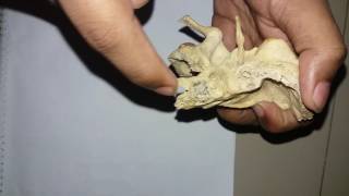 Temporal bone Part2Bangla tutorial [upl. by Garry]