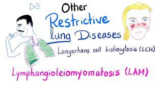 Langerhans cell Histiocytosis LCH and Lymphangioleiomyomatosis LAM  Respiratory Pathology [upl. by River]