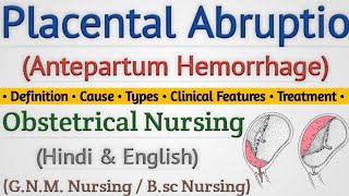 Placental Abruptio In Hindi  Abruptio Placenta क्या होता है  Antepartum Hemorrhage Lecture [upl. by Hamfurd523]