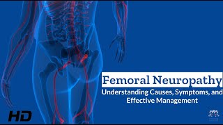 Femoral Neuropathy Unveiled What You Need to Know [upl. by Yniar]