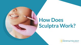 Sculptra Filler Treatment for Facial Volume [upl. by Arted30]