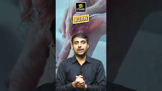 Bacteria is most commonly responsible for the sepsis in the burn patient shorts mukeshsir [upl. by Tiphanie]