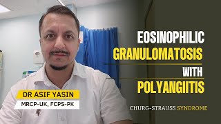 Eosinophilic Granulomatosis with Polyangiitis  ChurgStrauss Syndrome mbbs NRE plab fmge [upl. by Arotal]