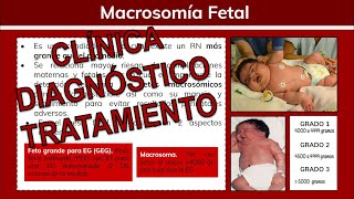 ⚕️🩺 Alteraciones del Crecimiento Fetal MACROSOMÍA FETAL  Ginecología [upl. by Asirap]