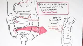 Amoebic dysentery Entamoeba Histolytica YouTube [upl. by Colin539]