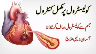 Cholesterol Kam Karne Ke Gharelu Ilaj In Urdu  How to control cholesterol In UrduHindi [upl. by Grous655]