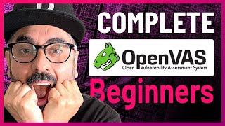 Complete Beginner OpenVAS Vulnerability Scanning Tutorial  Cyber Security  Kali Linux [upl. by Ji234]