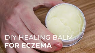 Tutorial for making a Natural Healing Cream for Eczema and Psoriasis [upl. by Metts]