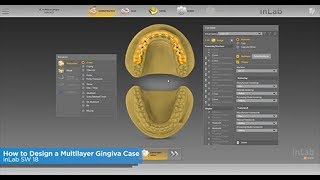 inLab SW 18 How to Design a Multilayer Gingiva Case [upl. by Rimidalv]