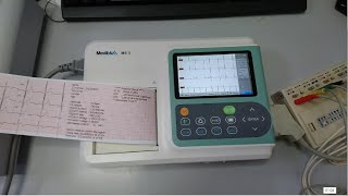 ECG Mediblu ME3  Test và kiểm tra máy đo điện tim  NewTech NeuCardio E3  Biocare iE 300 [upl. by Dehlia134]