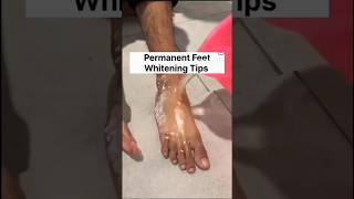 FEET WHITENING SECRETS REVEALED 🤫 Permanent Solutions for Dark Feet shorts shortsfeed [upl. by Sitsuj]