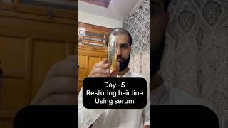 Restoring Hair Line Day5 using serum hairregrowth haircareroutine [upl. by Litch]