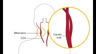 The anatomy of the extracranial arteries a review [upl. by Aym]