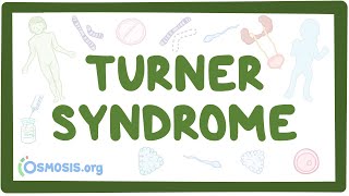 Turner syndrome Year of the Zebra [upl. by Budding]