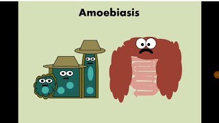 Entamoeba histolytica Amoebiasis الأميبا  الدوسنتاريا [upl. by Eresed462]