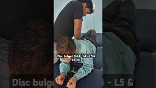 Chiropractic Relief for L3L5 Disc Bulge youngspineclinic [upl. by Simaj]