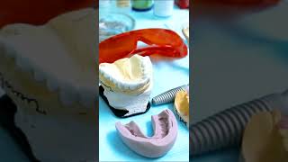 3 Common Types of Oral Surgery What to Know amp Do [upl. by Hoppe495]