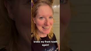 broke my front tooth again [upl. by Ezalb249]