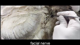 Facial nerve anatomy [upl. by Michaela]