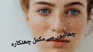 Freckle treatmentpigmentation permanent curechayun is ilaj [upl. by Zoes]