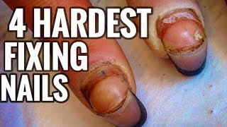 4 HARDEST TRANSFORMATIONS OF LIFES AND NAILS IN ONE VIDEO  TOUCHING MOVIE OF REAL LIFE [upl. by Eylrahc233]