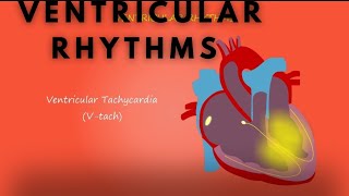 ventricular Rhythms tachycardia amp bradycardia [upl. by Budge]