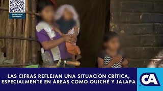 Entrevista Situación de la desnutrición infantil en Guatemala [upl. by Clo]