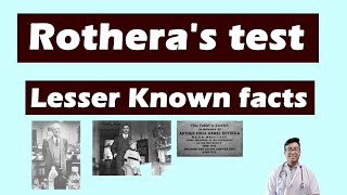 Rotheras Test  Lesser known facts for Class Assistant Gold Medal examinations and PG students [upl. by Salot]