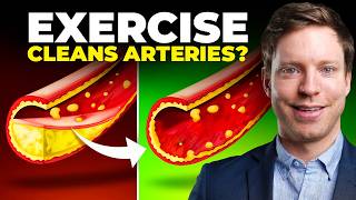 This Exercise Clears Plaque in Your Arteries New Trial [upl. by Zeta]