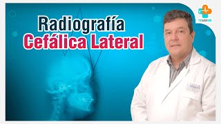 Radiografía Cefálica Lateral  Tu Salud Guía [upl. by Naashom]