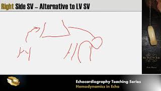 Lecture 8  Hemodynamics in Echocardiography [upl. by Mac]