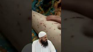 Worms 🪱 horribePETowner ringworm fleas hookworms [upl. by Luther812]