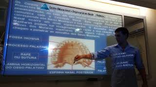 Anatomia Óssea  Palato [upl. by Ynnej103]