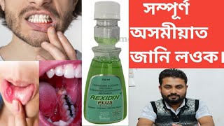 REXIDIN PLUS Mouthwash  Antiseptic  Anticaries Solution [upl. by Yerot]