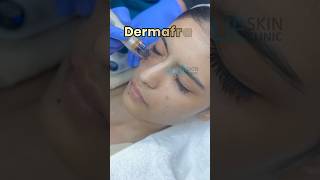 Skin treatment pigmentation treatment  Facial for skin glow  glowing skin facial [upl. by Blalock]