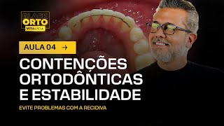 Aula 49  Contenções ortodônticas e estabilidade [upl. by Flem]