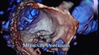 Musculi Pectinati [upl. by Aicilaf730]