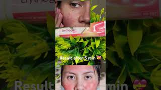 Skin redness cream acne redness scars treatment youtubeshorts viralvideo skincare erythego [upl. by Adiari]