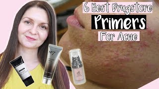 Best Drugstore Primers For Acne Prone Skin 2019  Noncomedogenic Primers [upl. by Anilak]