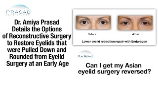 The Challenges of Reversing Almond Shaped Eye Surgery Performed at a Very Young Age [upl. by Renaud859]