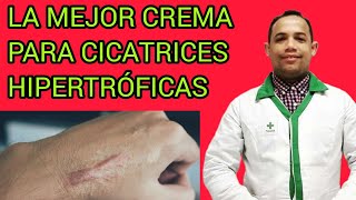 LA MEJOR CREMA PARA CICATRICES HIPERTRÓFICAS [upl. by Nicholle]