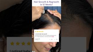 Rolling to Regrowth  Honest Reviews of Hair Serum RollOns HairgrowthReviews RollOnSerum [upl. by Yonita419]