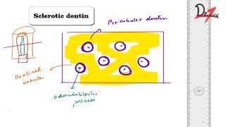 What is Sclerotic dentin [upl. by Dahl]