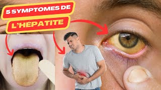 5 symptômes de lhépatite  hépatite virale c  hépatite virale b  hepatite a  hépatite [upl. by Maire]