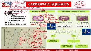 Qx cardiologia  CLASIFICACION Y DIAGNOSTICO SICA [upl. by Alpert608]