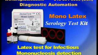 Mono Infectious Mononucleosis Serology kit [upl. by Trinatte]