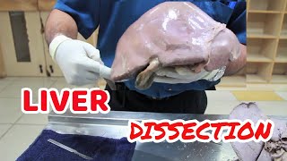 Anatomy Dissection of Liver [upl. by Othella]