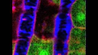 NIDCR Liver Vascular Flow [upl. by Rheinlander556]