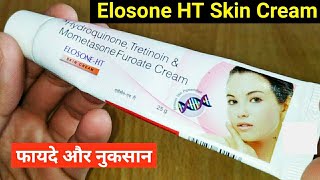 Elosone HT Skin Cream Ke Fayde Or Nuksan  Hydroquinone Tretinoin amp Mometasone Furoate Cream [upl. by Arakat625]