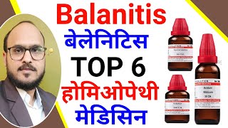 Balanitis  Best Treatment of Balanitis  Best Homeopathic Doctor in India  Balanitis treatment [upl. by Novaelc]